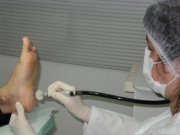 Podologia calosidade
